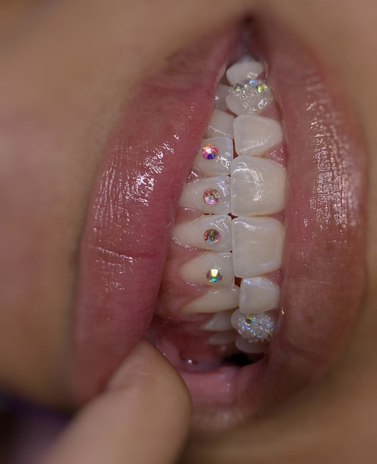 Tooth Gem Starter Kit – Lush Beauty & Aesthetics